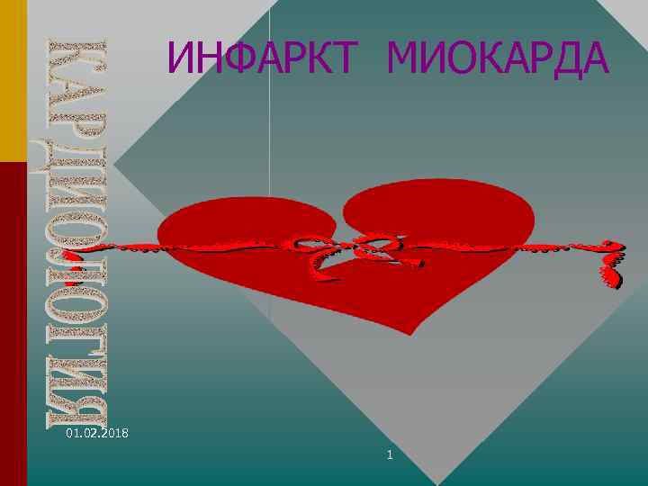 ИНФАРКТ МИОКАРДА 01. 02. 2018 1 