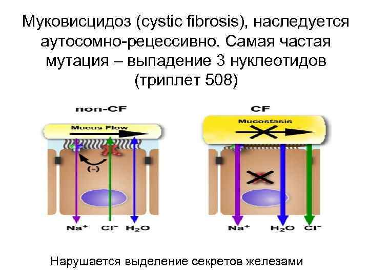 Муковисцидоз (cystic fibrosis), наследуется аутосомно-рецессивно. Самая частая мутация – выпадение 3 нуклеотидов (триплет 508)