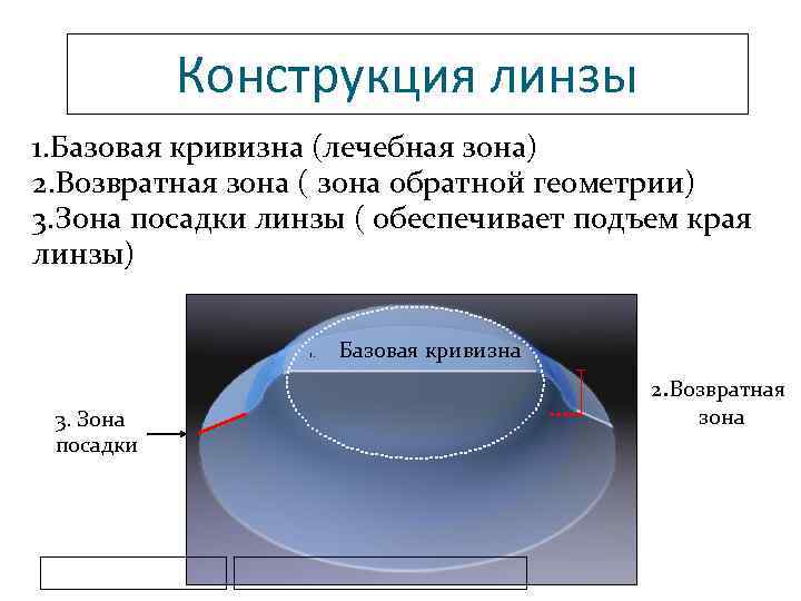 Конструкция линзы 1. Базовая кривизна (лечебная зона) 2. Возвратная зона ( зона обратной геометрии)