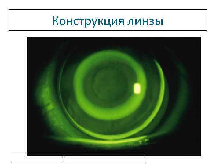 Конструкция линзы 