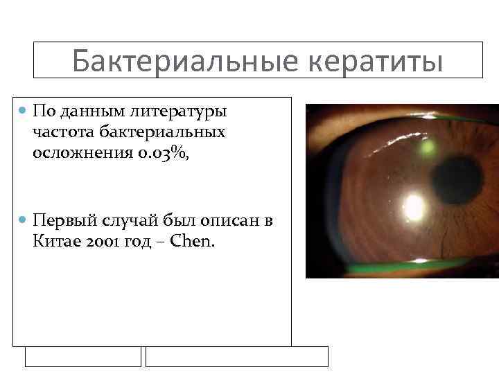 Бактериальные кератиты По данным литературы частота бактериальных осложнения 0. 03%, Первый случай был описан