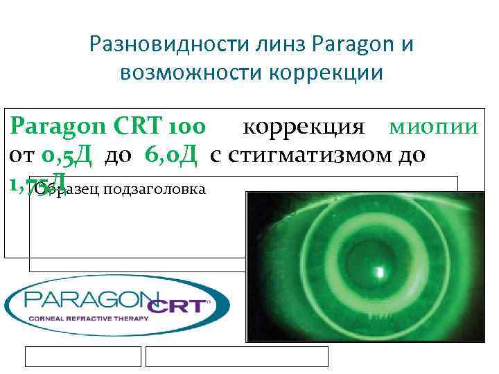Разновидности линз Paragon и возможности коррекции Paragon CRT 100 коррекция миопии от 0, 5