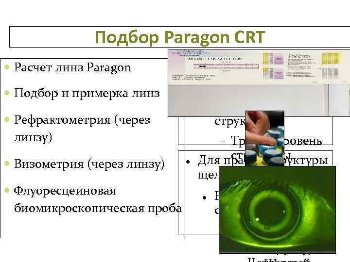 Подбор Paragon CRT Расчет линз Paragon Подбор и примерка линз Для правки структуры щелкните