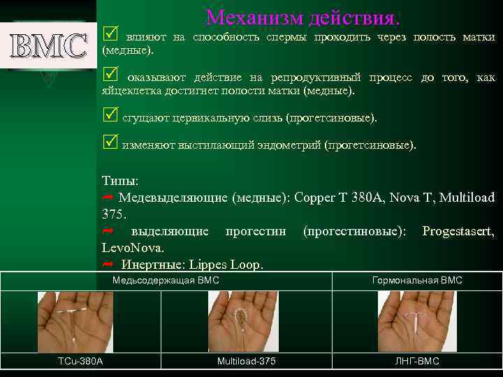 ВМС Механизм действия. R влияют на способность спермы проходить через полость матки (медные). R