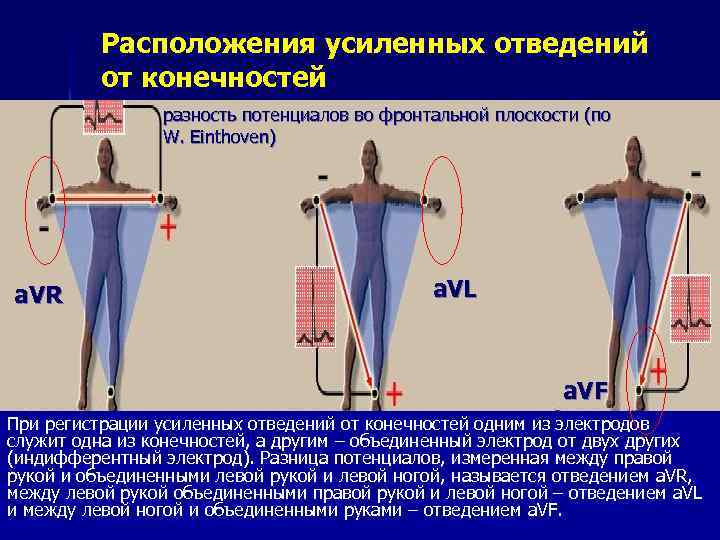 Расположения усиленных отведений от конечностей разность потенциалов во фронтальной плоскости (по W. Einthoven) a.