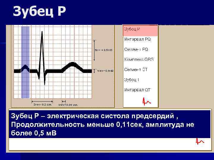 Зубец Р – электрическая систола предсердий , Продолжительность меньше 0, 11 сек, амплитуда не