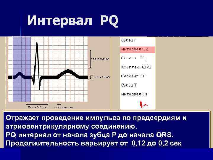 Интервал PQ Отражает проведение импульса по предсердиям и атриовентрикулярному соединению. PQ интервал от начала