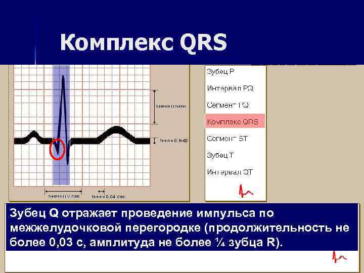 Комплекс QRS Зубец Q отражает проведение импульса по межжелудочковой перегородке (продолжительность не более 0,