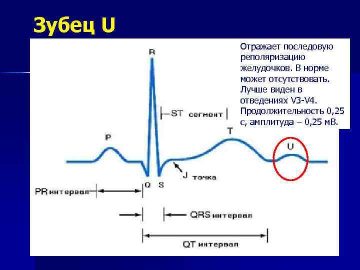 Зубец U Отражает последовую реполяризацию желудочков. В норме может отсутствовать. Лучше виден в отведениях