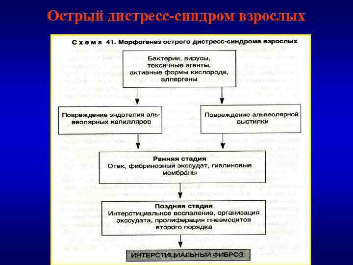 Острый дистресс-синдром взрослых 
