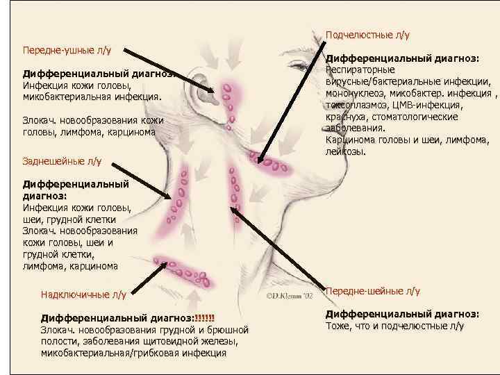 Подчелюстные л/у Передне-ушные л/у Дифференциальный диагноз: Инфекция кожи головы, микобактериальная инфекция. Злокач. новообразования кожи