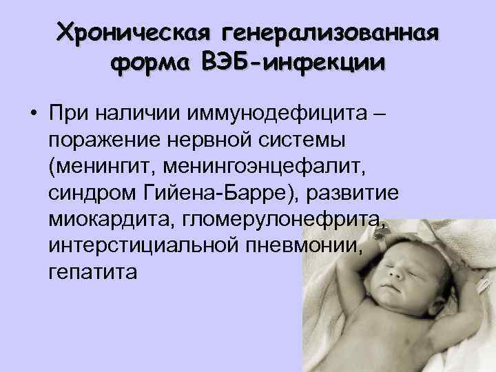 Хроническая генерализованная форма ВЭБ-инфекции • При наличии иммунодефицита – поражение нервной системы (менингит, менингоэнцефалит,