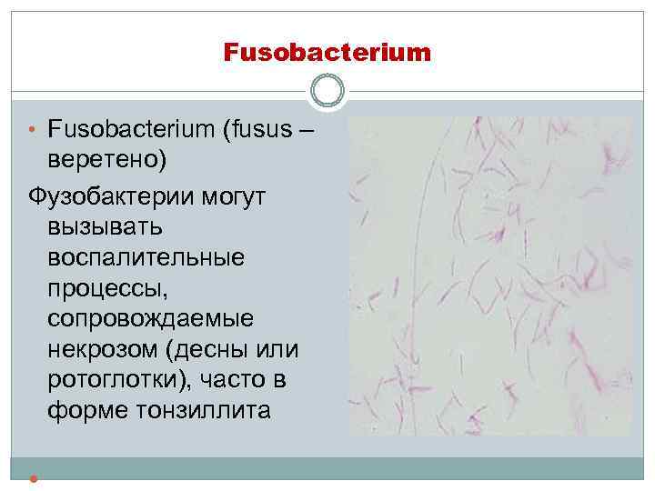 Fusobacterium • Fusobacterium (fusus – веретено) Фузобактерии могут вызывать воспалительные процессы, сопровождаемые некрозом (десны