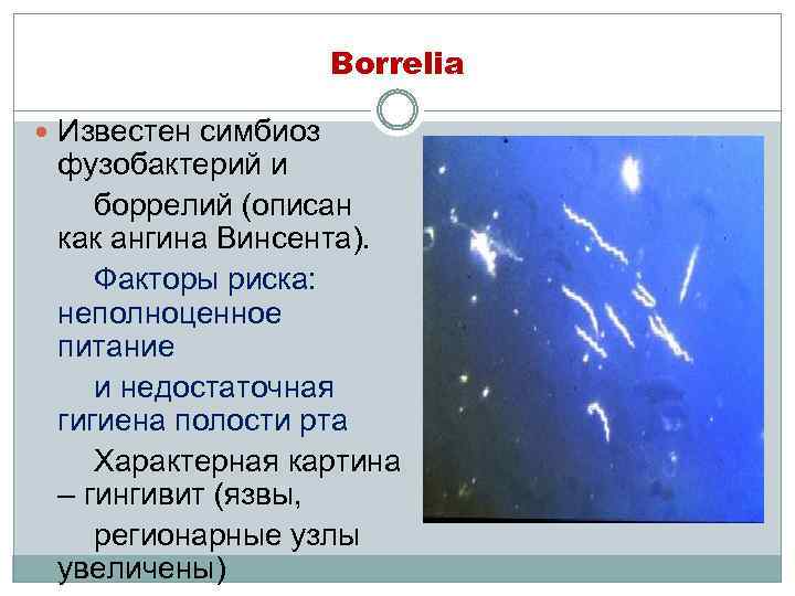 Borrelia Известен симбиоз фузобактерий и боррелий (описан как ангина Винсента). Факторы риска: неполноценное питание