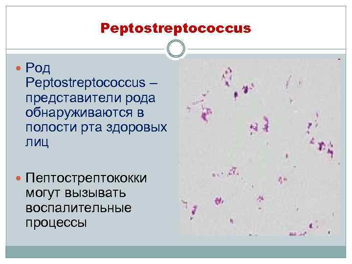 Peptostreptococcus SPP В ротовой полости. Микробиоценоз. Грамотрицательные бактерий, входящих в микробиоценоз полости рта..