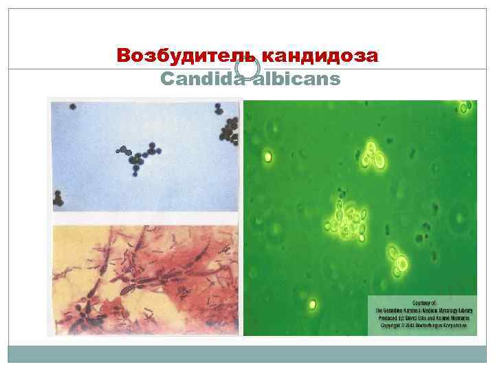 Возбудитель кандидоза Candida albicans 
