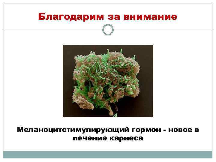 Благодарим за внимание Меланоцитстимулирующий гормон - новое в лечение кариеса 