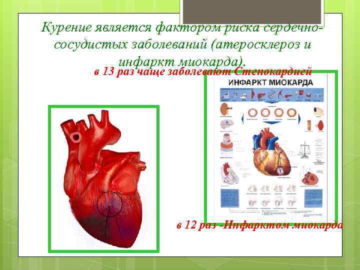 Курение является фактором риска сердечнососудистых заболеваний (атеросклероз и инфаркт миокарда). в 13 раз чаще