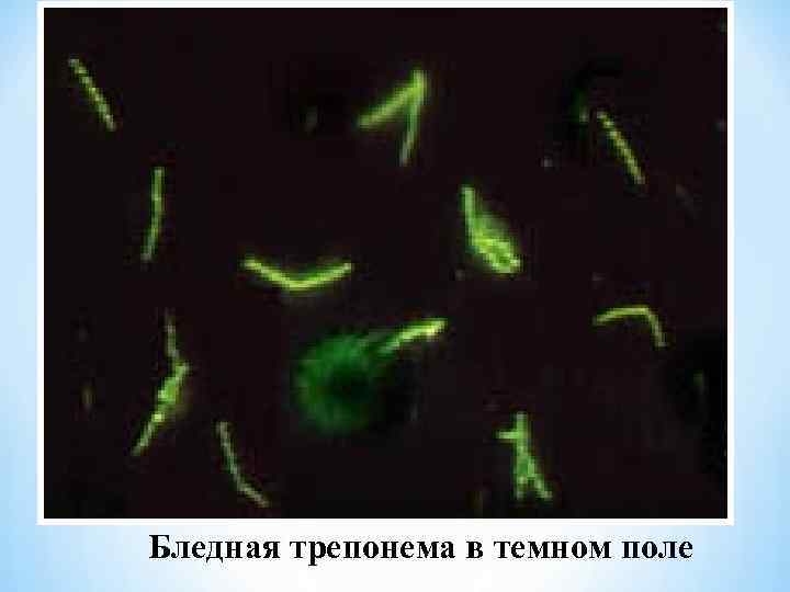 Бледная трепонема в темном поле 