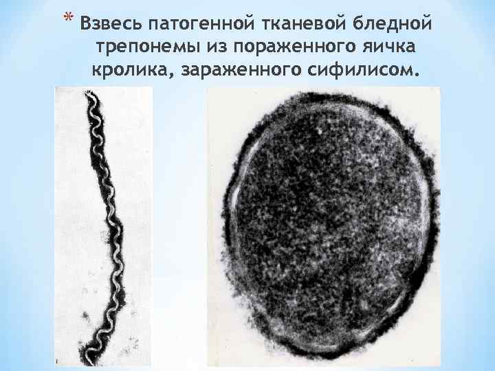 * Взвесь патогенной тканевой бледной трепонемы из пораженного яичка кролика, зараженного сифилисом. 
