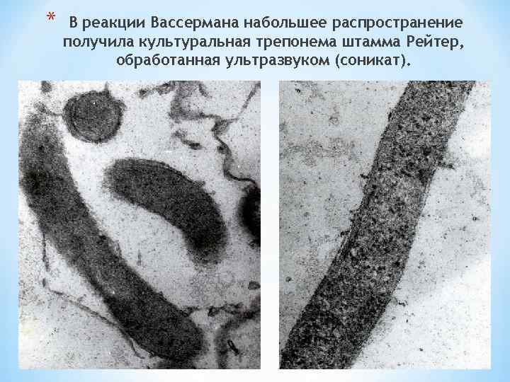 * В реакции Вассермана набольшее распространение получила культуральная трепонема штамма Рейтер, обработанная ультразвуком (соникат).