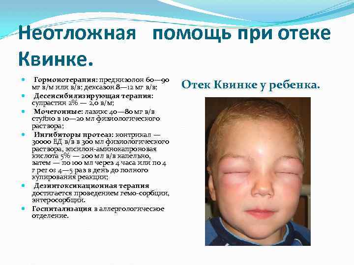 Неотложная помощь при отеке Квинке. Гормонотерапия: преднизолон 60— 90 мг в/м или в/в; дексазон