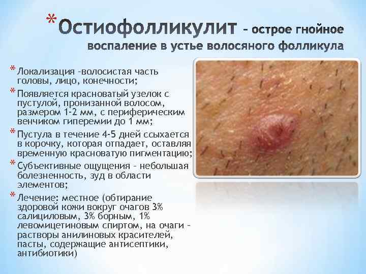 * * Локализация –волосистая часть головы, лицо, конечности; * Появляется красноватый узелок с пустулой,