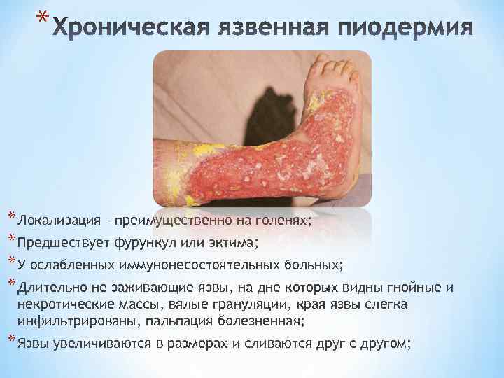 * * Локализация – преимущественно на голенях; * Предшествует фурункул или эктима; * У