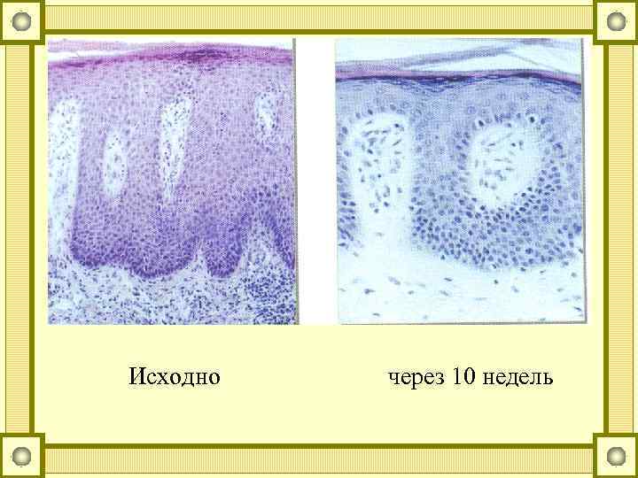 Исходно через 10 недель 