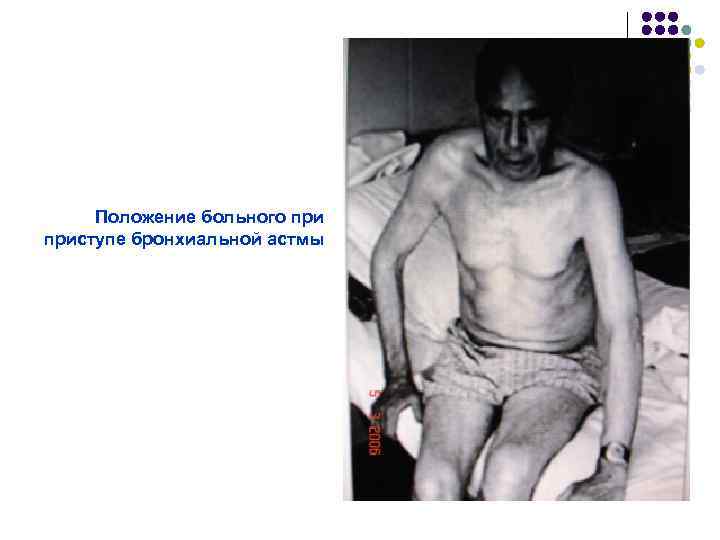 Положение больного приступе бронхиальной астмы 