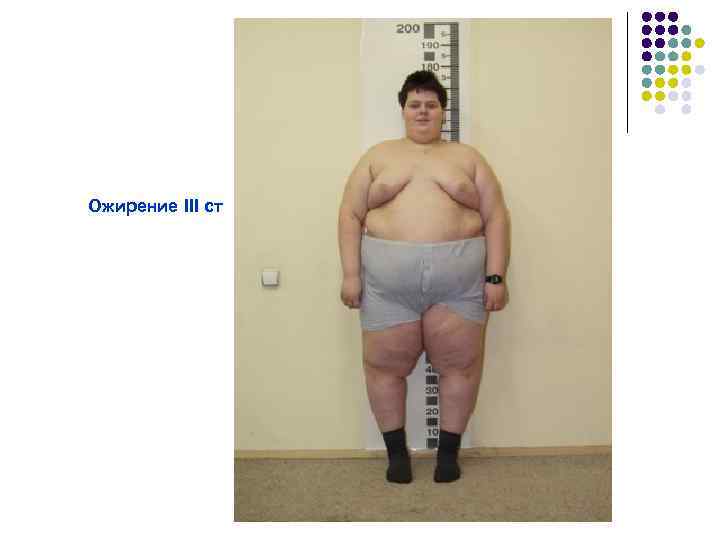 Ожирение III ст 