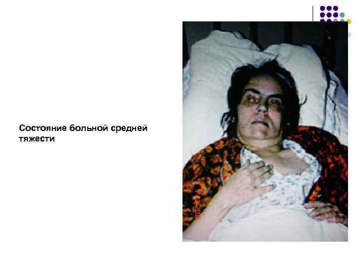 Состояние больной средней тяжести 