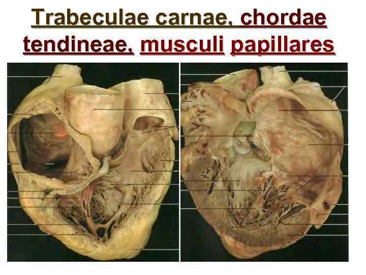 Тrabeculae carnae, chordae tendineae, musculi papillares 