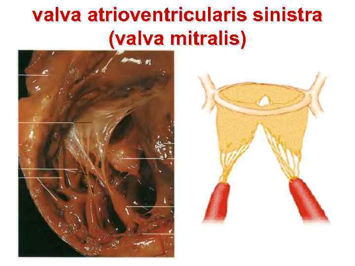 valva atrioventricularis sinistra (valva mitralis) 