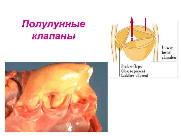 Полулунные клапаны 