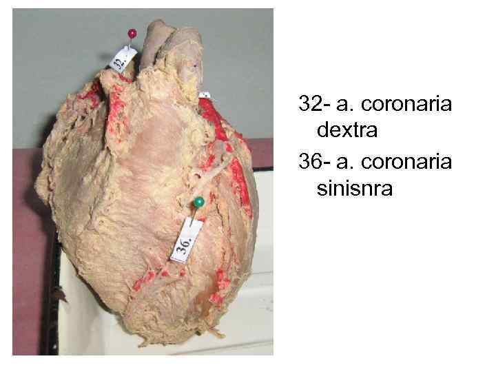 32 - a. coronaria dextra 36 - a. coronaria sinisnra 