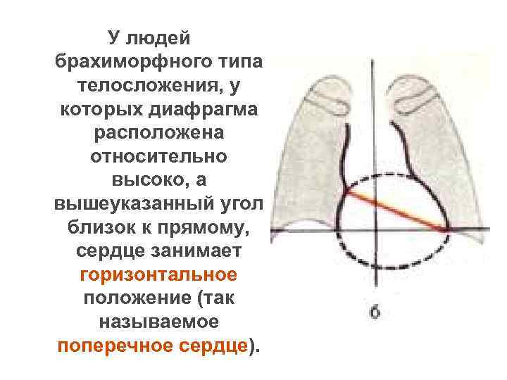 У людей брахиморфного типа телосложения, у которых диафрагма расположена относительно высоко, а вышеуказанный угол