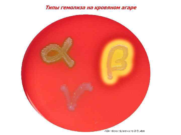 Типы гемолиза на кровяном агаре 