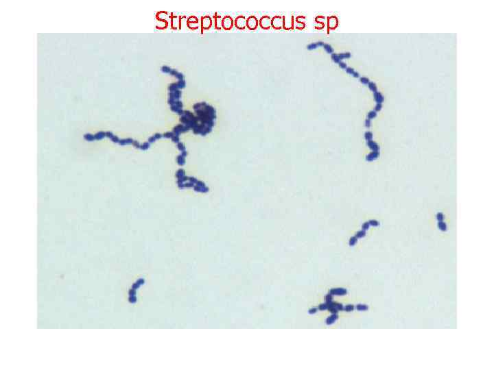 Streptococcus sp 