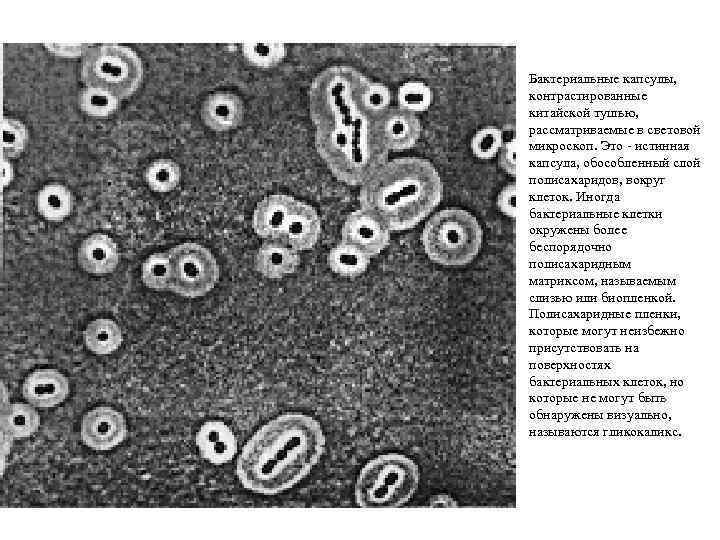 Бактериальные капсулы, контрастированные китайской тушью, рассматриваемые в световой микроскоп. Это - истинная капсула, обособленный