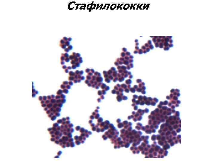 Стафилококки 