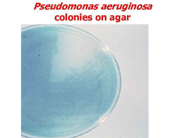 Pseudomonas aeruginosa colonies on agar 