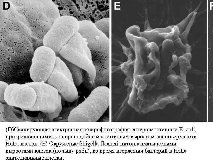 (D)Сканирующая электронная микрофотография энтеропатогенных Е. coli, прикрепляющихся к опороподобным клеточным выростам на поверхности He.