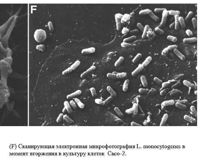 (F) Сканирующая электронная микрофотография L. monocytogenes в момент вторжения в культуру клеток Caco-2. 