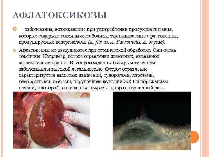 АФЛАТОКСИКОЗЫ - заболевания, возникающие при употреблении продуктов питания, которые содержат токсины-метаболиты, так называемые афлатоксины,