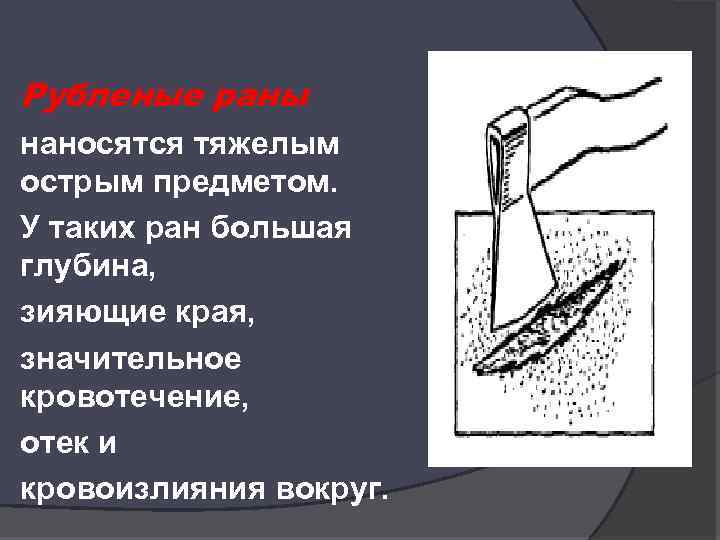 Колото резанный. Рубленые раны- наносятся острым предметом.. Резаные колотые рубленые раны.