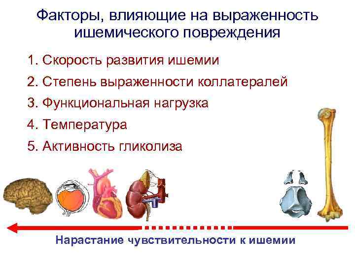 Факторы, влияющие на выраженность ишемического повреждения 1. Скорость развития ишемии 2. Степень выраженности коллатералей