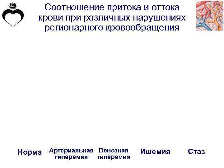 Соотношение притока и оттока крови при различных нарушениях регионарного кровообращения Норма Артериальная Венозная гиперемия