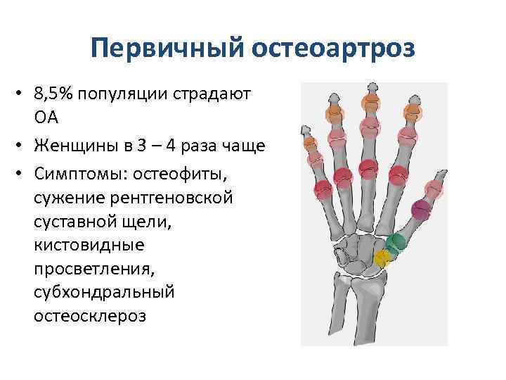 Остеоартроз кисти 1 степени