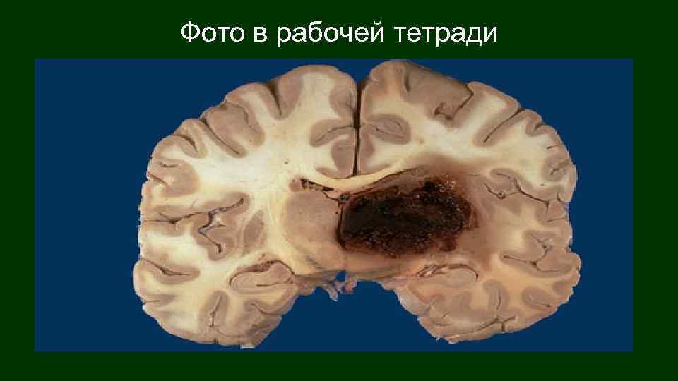 Фото в рабочей тетради 